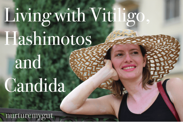 Living with Vitiligo, Hashimotos and Candida